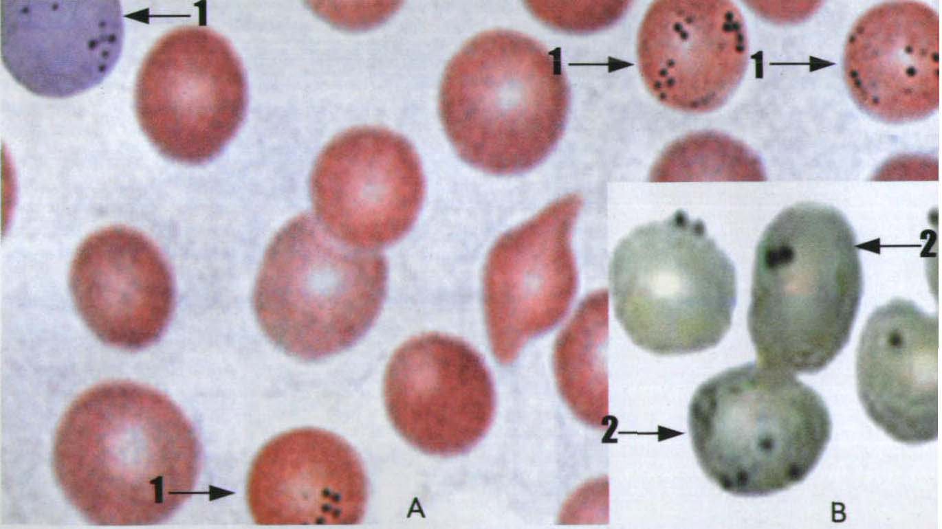 图3 嗜碱性点彩红细胞